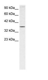HOXA7 Antibody - Jurkat Cell Lysate.  This image was taken for the unconjugated form of this product. Other forms have not been tested.
