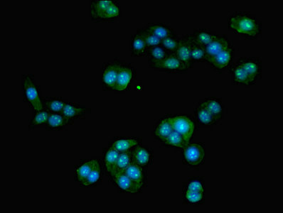HOXA9 Antibody - Immunofluorescent analysis of PC-3 cells using HOXA9 Antibody at dilution of 1:100 and Alexa Fluor 488-congugated AffiniPure Goat Anti-Rabbit IgG(H+L)