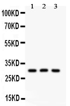 HOXA9 Antibody - HOXA9 antibody Western blot. All lanes: Anti HOXA9 at 0.5 ug/ml. Lane 1: Rat Testis Tissue Lysate at 50 ug. Lane 2: HEPG2 Whole Cell Lysate at 40 ug. Lane 3: HEPA Whole Cell Lysate at 40 ug. Predicted band size: 30 kD. Observed band size: 30 kD.
