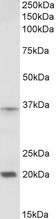 HOXA9 Antibody - Goat Anti-HOXA9 (aa49-60) Antibody (2µg/ml) staining of Moue Spleen lysate (35µg protein in RIPA buffer). Primary incubation was 1 hour. Detected by chemiluminescencence.