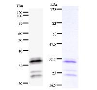 HOXA9 Antibody - Left : Western blot analysis of immunized recombinant protein, using anti-HOXA9 monoclonal antibody. Right : CBB staining of immunized recombinant protein.