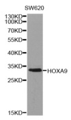 HOXA9 Antibody - Western blot analysis of extracts of SW620 cell line, using HOXA9 antibody.