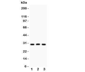 HOXA9 Antibody - Western blot testing of HOXA9 antibody and Lane 1: rat testis; 2: human HEPG2; 3: mouse HEPA lysate. Expected/observed size ~30KD