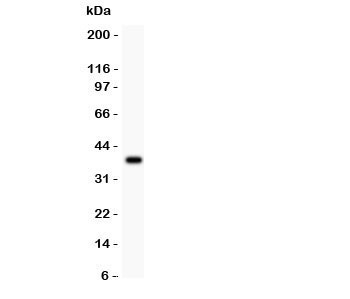 HOXA9 Antibody - Western blot testing of HOXA9 antibody and recombinant human protein (0.5ng)