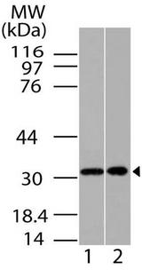 HOXA9 Antibody - Fig-1: Western blot analysis of  HOXA9. Anti-HOXA9 antibody was used at 2 µg/ml on 1) HCT-116 and 2) HepG2 lysates. 