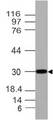 HOXA9 Antibody - Fig-1: Expression analysis of HOXA9. Anti-HOXA9 antibody was used at 1 µg/ml on h Liver lysate.