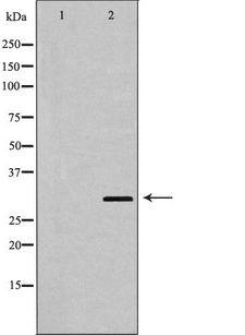 HOXA9 Antibody - Western blot analysis of extracts of SW620 using HOXA9 antibody. The lane on the left is treated with the antigen-specific peptide.