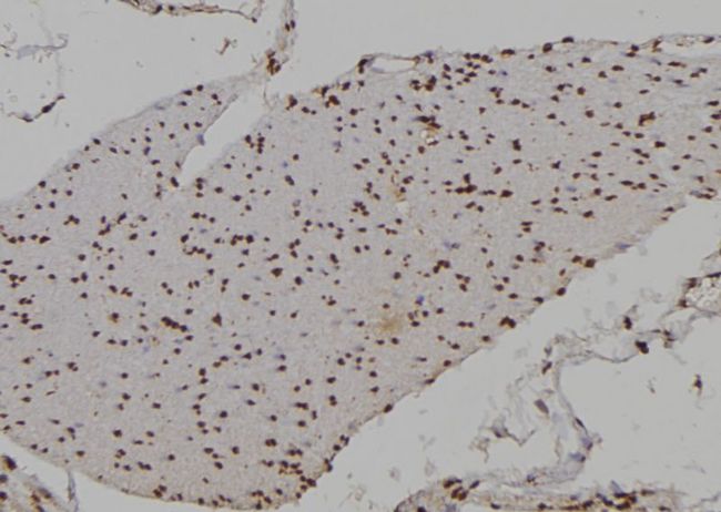 HOXA9 Antibody - 1:100 staining human gastric tissue by IHC-P. The sample was formaldehyde fixed and a heat mediated antigen retrieval step in citrate buffer was performed. The sample was then blocked and incubated with the antibody for 1.5 hours at 22°C. An HRP conjugated goat anti-rabbit antibody was used as the secondary.
