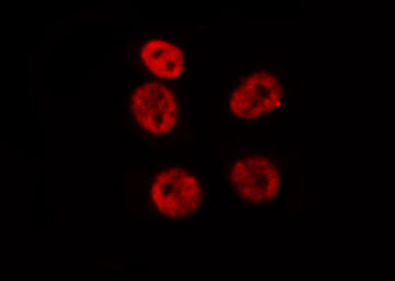 HOXA9 Antibody - Staining HepG2 cells by IF/ICC. The samples were fixed with PFA and permeabilized in 0.1% Triton X-100, then blocked in 10% serum for 45 min at 25°C. The primary antibody was diluted at 1:200 and incubated with the sample for 1 hour at 37°C. An Alexa Fluor 594 conjugated goat anti-rabbit IgG (H+L) antibody, diluted at 1/600, was used as secondary antibody.