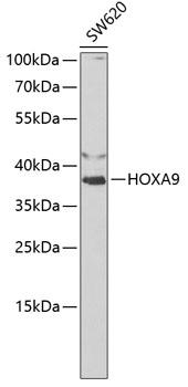 HOXA9 Antibody - Western blot analysis of extracts of SW620 cells using HOXA9 Polyclonal Antibody at dilution of 1:1000.