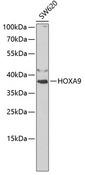 HOXA9 Antibody - Western blot analysis of extracts of SW620 cells using HOXA9 Polyclonal Antibody at dilution of 1:1000.