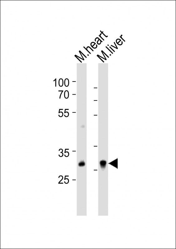HOXB1 Antibody - All lanes : Anti-Hoxb1 Antibody at 1:1000 dilution Lane 1: mouse heart lysates Lane 2: mouse liver lysates Lysates/proteins at 20 ug per lane. Secondary Goat Anti-Rabbit IgG, (H+L), Peroxidase conjugated at 1/10000 dilution Predicted band size : 32 kDa Blocking/Dilution buffer: 5% NFDM/TBST.
