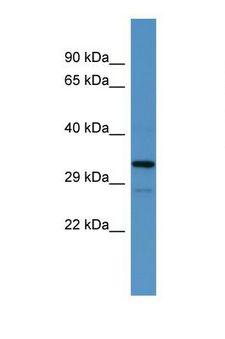 HOXB1 Antibody - Western blot of Rat Brain. Hoxb1 antibody dilution 1.0 ug/ml.  This image was taken for the unconjugated form of this product. Other forms have not been tested.