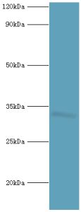 HOXB1 Antibody - Western blot. All lanes: Homeobox protein Hox-B1 antibody at 9 ug/ml+mouse liver tissue. Secondary antibody: Goat polyclonal to rabbit at 1:10000 dilution. Predicted band size: 32 kDa. Observed band size: 32 kDa.
