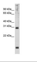 HOXB1 Antibody - SP2/0 Cell Lysate.  This image was taken for the unconjugated form of this product. Other forms have not been tested.
