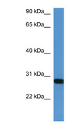 HOXB1 Antibody - HOXB1 antibody Western blot of Mouse Heart lysate. This image was taken for the unconjugated form of this product. Other forms have not been tested.