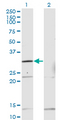 HOXB1 Antibody - Western blot of HOXB1 expression in transfected 293T cell line by HOXB1 monoclonal antibody (M13), clone 2E5.