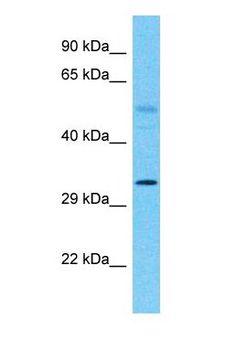 HOXB1 Antibody - Western blot of HOXB1 Antibody with Fetal Lung lysate.  This image was taken for the unconjugated form of this product. Other forms have not been tested.