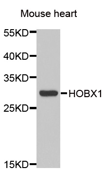 HOXB1 Antibody - Western blot analysis of extracts of Mouse heart cells.