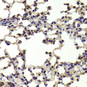 HOXB1 Antibody - Immunohistochemistry of paraffin-embedded Mouse lung tissue.