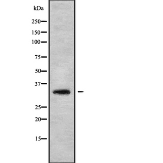 HOXB1 Antibody - Western blot analysis of HOXB1 using LOVO cells whole cells lysates