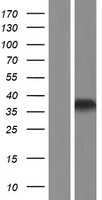 HOXB1 Protein - Western validation with an anti-DDK antibody * L: Control HEK293 lysate R: Over-expression lysate