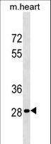 HOXB13 Antibody - HOXB13 Antibody western blot of mouse heart tissue lysates (35 ug/lane). The HOXB13 antibody detected the HOXB13 protein (arrow).