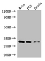 HOXB13 Antibody - Positive WB detected in:Hela whole cell lysate,PC3 whole cell lysate,Mouse brain tissue;All lanes: HOXB13 antibody at 3ug/ml;Secondary;Goat polyclonal to rabbit IgG at 1/50000 dilution;Predicted band size: 31 kDa;Observed band size: 31 kDa;