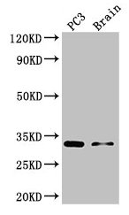 HOXB13 Antibody - Western Blot Positive WB detected in: PC-3 whole cell lysate, Mouse brain tissue All lanes: HOXB13 antibody at 3µg/ml Secondary Goat polyclonal to rabbit IgG at 1/50000 dilution Predicted band size: 31 kDa Observed band size: 31 kDa