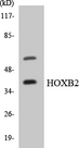 HOXB2 Antibody - Western blot analysis of the lysates from HUVECcells using HOXB2 antibody.