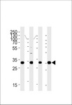 HOXB2 Antibody - HOXB2 Antibody western blot of HeLa, SiHa, U251, U87-MG cell line lysates (35 ug/lane). The HOXB2 antibody detected the HOXB2 protein (arrow).