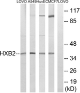 HOXB2 Antibody - Western blot analysis of lysates from MCF-7, HUVEC, A549, and LOVO cells, using HOXB2 Antibody. The lane on the right is blocked with the synthesized peptide.