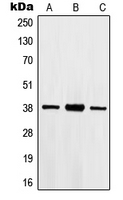 HOXB2 Antibody - Western blot analysis of HOXB2 expression in Jurkat (A); HepG2 (B); A549 (C) whole cell lysates.