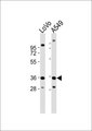 HOXB2 Antibody - All lanes : Anti-HOXB2 Antibody at 1:1000 dilution Lane 1: LoVo whole cell lysates Lane 2: A549 whole cell lysates Lysates/proteins at 20 ug per lane. Secondary Goat Anti-Rabbit IgG, (H+L),Peroxidase conjugated at 1/10000 dilution Predicted band size : 38 kDa Blocking/Dilution buffer: 5% NFDM/TBST.