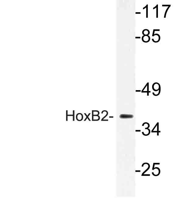 HOXB2 Antibody - Western blot of HoxB2 (P67) pAb in extracts from LOVO cells.
