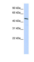 HOXB3 Antibody - HOXB3 Antibody Western blot of HepG2 cell lysate. This image was taken for the unconjugated form of this product. Other forms have not been tested.