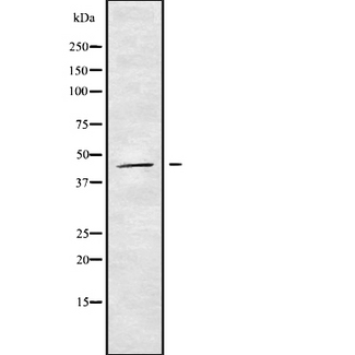 HOXB3 Antibody - Western blot analysis of HOXB3 using K562 whole cells lysates