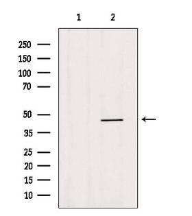 HOXB3 Antibody - Western blot analysis of extracts of c476 using HOXB3 antibody. Lane 1 was treated with the blocking peptide.