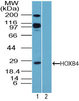 HOXB4 Antibody - Western blot of HOXB4 in K562 cell lysate in the 1) absence and 2) presence of immunizing peptide using Peptide-affinity Purified Polyclonal Antibody to HOXB4 at 1 ug/ml. Goat anti-rabbit Ig HRP secondary antibody, and PicoTect ECL substrate solution, were used for this test.