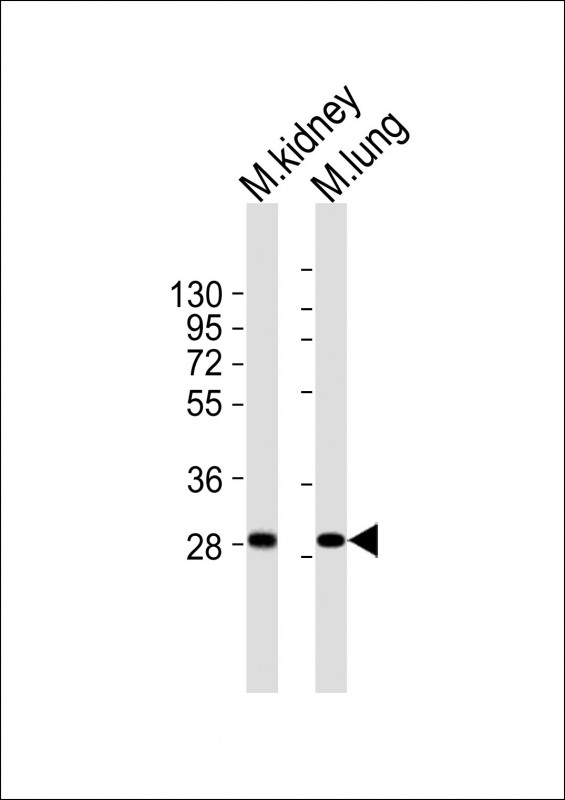 HOXB4 Antibody - All lanes : Anti-Hoxb4 Antibody at 1:1000 dilution Lane 1: mouse kidney lysates Lane 2: mouse lung lysates Lysates/proteins at 20 ug per lane. Secondary Goat Anti-Rabbit IgG, (H+L), Peroxidase conjugated at 1/10000 dilution Predicted band size : 28 kDa Blocking/Dilution buffer: 5% NFDM/TBST.