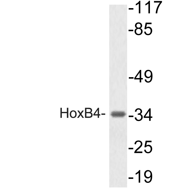HOXB4 Antibody - Western blot analysis of lysate from HT29 cells, using HoxB4 antibody.