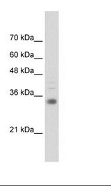 HOXB4 Antibody - Transfected 293T Cell Lysate.  This image was taken for the unconjugated form of this product. Other forms have not been tested.