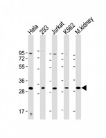 HOXB4 Antibody - All lanes: Anti-HOXB4 Antibody (Center) at 1:2000 dilution Lane 1: Hela whole cell lysate Lane 2: 293 whole cell lysate Lane 3: Jurkat whole cell lysate Lane 4: K562 whole cell lysate Lane 5: mouse kidney lysate Lysates/proteins at 20 µg per lane. Secondary Goat Anti-Rabbit IgG, (H+L), Peroxidase conjugated at 1/10000 dilution. Predicted band size: 28 kDa Blocking/Dilution buffer: 5% NFDM/TBST.