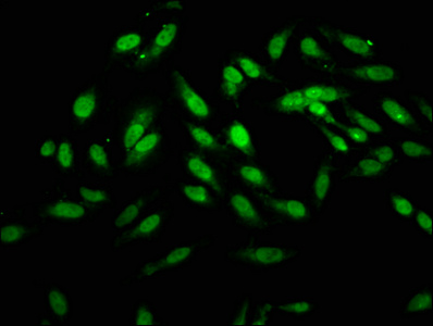 HOXB4 Antibody - Immunofluorescence staining of Hela cells at a dilution of 1:166, counter-stained with DAPI. The cells were fixed in 4% formaldehyde, permeabilized using 0.2% Triton X-100 and blocked in 10% normal Goat Serum. The cells were then incubated with the antibody overnight at 4 °C.The secondary antibody was Alexa Fluor 488-congugated AffiniPure Goat Anti-Rabbit IgG (H+L) .