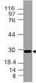 HOXB4 Antibody - Fig-1: Expression analysis of HOXB4. Anti-HOXB4 antibody was used at 2 µg/ml on h Kidney lysate.