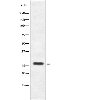 HOXB4 Antibody - Western blot analysis of HoxB4 using Jurkat whole cells lysates