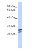 HOXB4 Antibody - HOXB4 antibody Western Blot of Jurkat.  This image was taken for the unconjugated form of this product. Other forms have not been tested.
