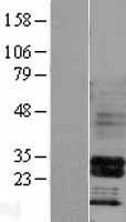 HOXB4 Protein - Western validation with an anti-DDK antibody * L: Control HEK293 lysate R: Over-expression lysate