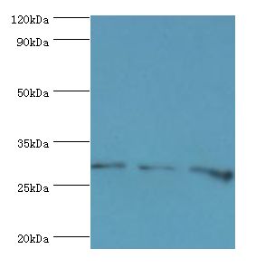 HOXB5 Antibody - Western blot. All lanes: Homeobox protein Hox-B5 antibody at 8 ug/ml. Lane 1: HepG2 whole cell lysate. Lane 2: rat liver tissue. Lane 3: rat lung tissue. secondary Goat polyclonal to rabbit at 1:10000 dilution. Predicted band size: 29 kDa. Observed band size: 29 kDa.