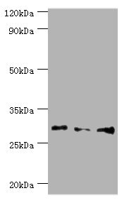 HOXB5 Antibody - Western blot All lanes: Homeobox protein Hox-B5 antibody at 8µg/ml Lane 1: HepG2 whole cell lysate Lane 2: Rat liver tissue Lane 3: Rat lung tissue Secondary Goat polyclonal to rabbit IgG at 1/10000 dilution Predicted band size: 29 kDa Observed band size: 29 kDa